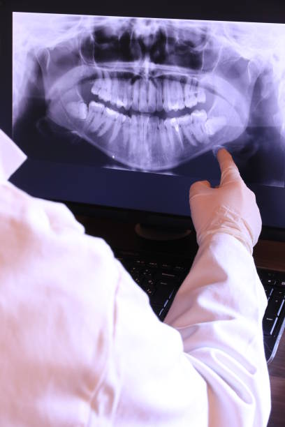 Best Knocked-Out Tooth (Avulsed Tooth) Treatment in Indian Lake, MO