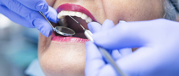 Trusted MO Emergency Dental Service Experts
